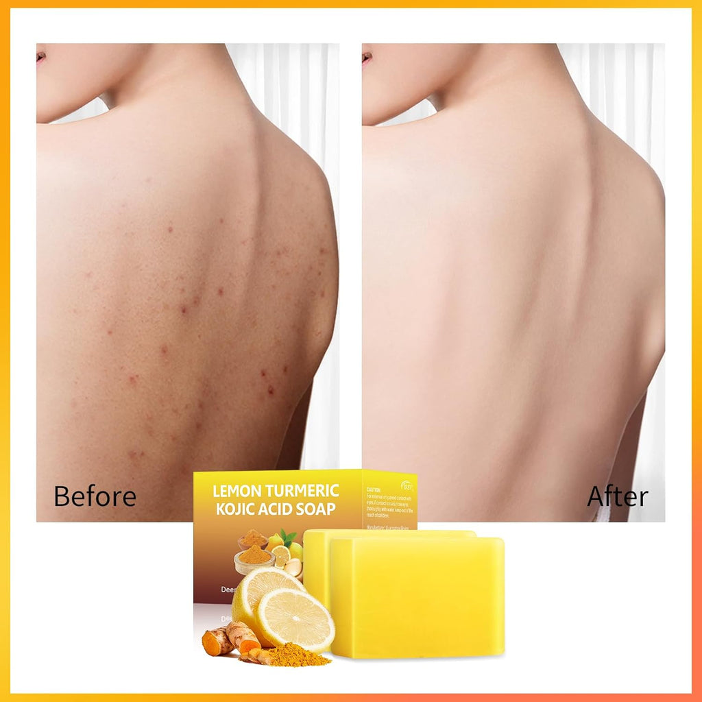 Lemon Turmeric Kojic Acid Soap Bar (2 Pack) Y530600